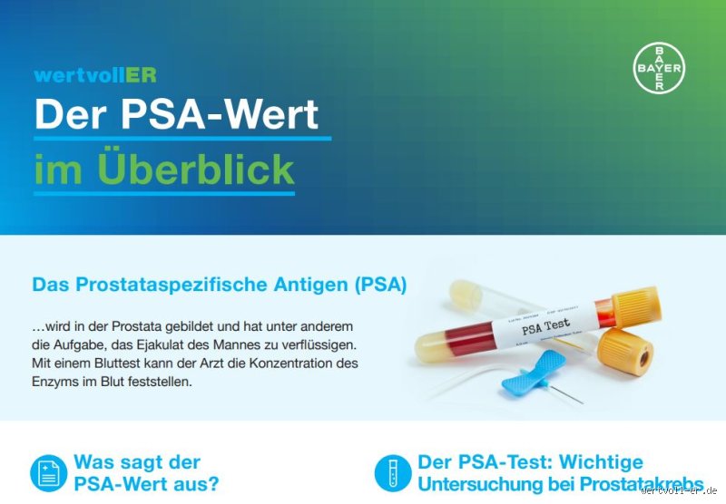 Wie lange dauert es bis der PSA-Wert sinkt? Alles, was du wissen musst