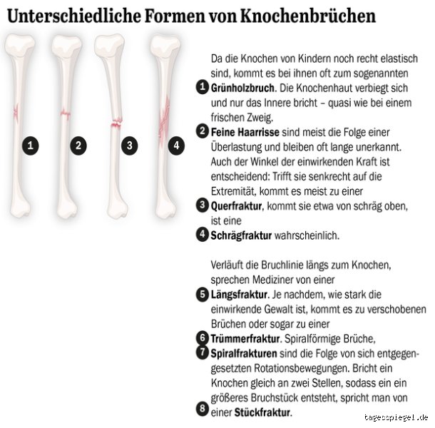 Wie lange dauert es, ein Trauma zu heilen?