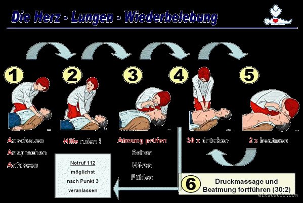 Wie lange maximal reanimieren?