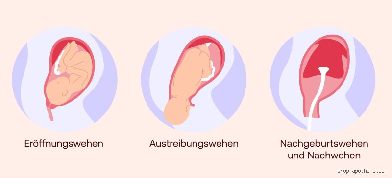 Wie lange nach der Geburt kann man Nachwehen haben?