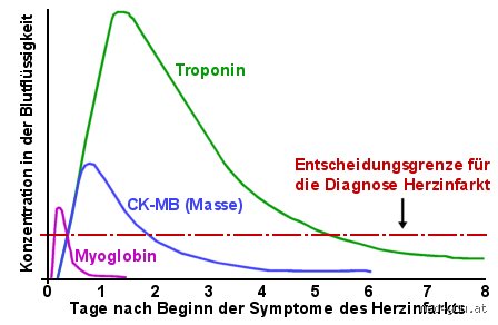 Wie schnell steigt der CK Wert wirklich an? Ein Blick hinter die Laborzahlen