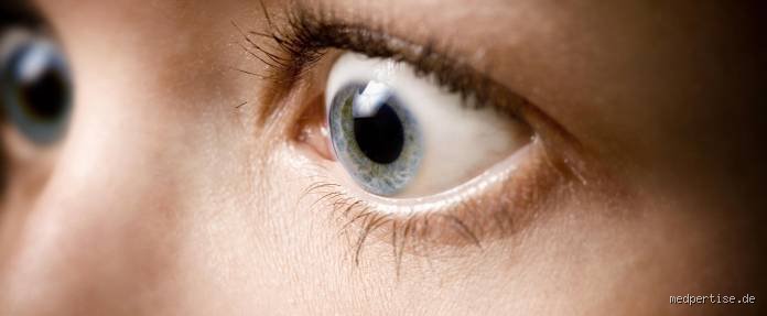 Wie sehen die Augen bei einer Schilddrüsenunterfunktion aus? – Alles Wissenswerte auf einen Blick