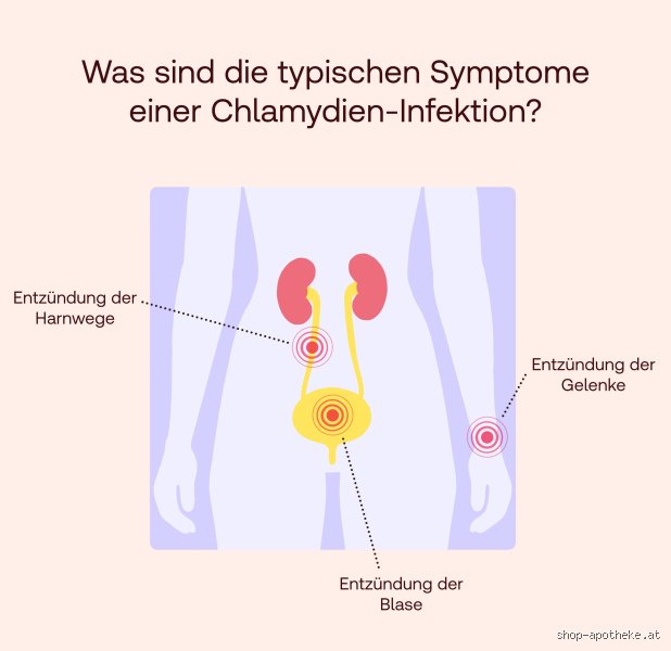 Wie sieht der Ausfluss bei Chlamydien aus?