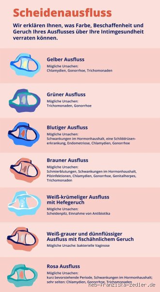 Wie sieht krankhafter Ausfluss wirklich aus? Die ehrliche Beschreibung, die man sonst nirgends hört