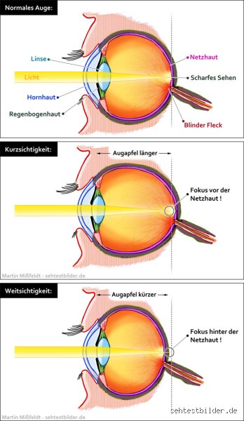Wie sind die Augen wenn man bekifft ist?