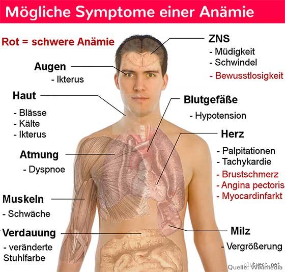 Wie verändert sich die Haut bei einer Anämie?