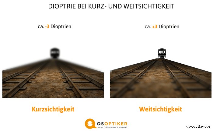 Wie viel Dioptrien sind gefährlich? Grenzwerte und medizinische Risiken im Überblick