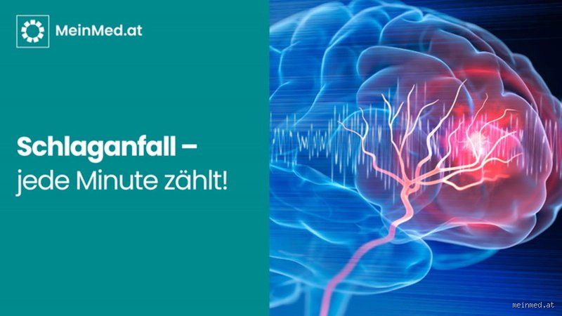 Wie wird ein Mini Schlaganfall behandelt?