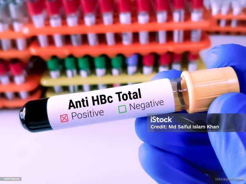 C'est quoi Anti-HBc totaux positif ? Comprendre les résultats de votre sérologie