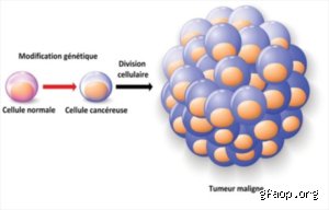 Qu'est-ce qu'un cancer musculaire exactement ? Comprendre les sarcomes des tissus mous