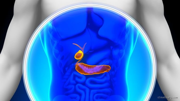 Comment avez-vous découvert que vous avez un cancer du pancréas ?