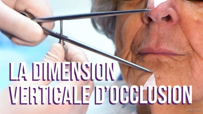Comment détermine-t-on la dimension verticale ? Les secrets d'une réhabilitation réussie