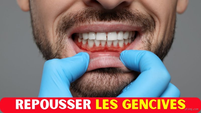 Comment stimuler la repousse des gencives ?