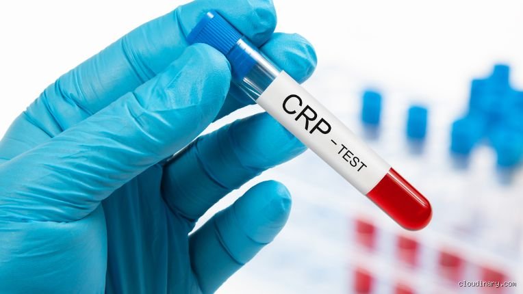 Est-ce que le cancer du pancréas peut augmenter la CRP ?