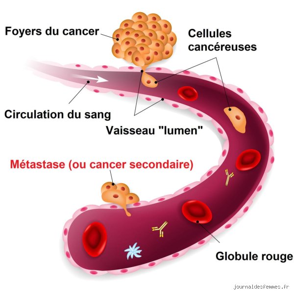 Est-ce que le cancer se voit dans le sang ?