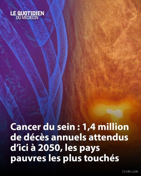 Éradiquer le cancer d'ici 2050 : fantasme de milliardaire ou réalité médicale imminente ?