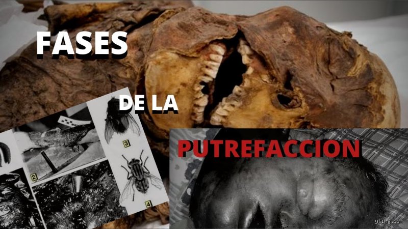 Quand commence la putréfaction d'un cadavre ?