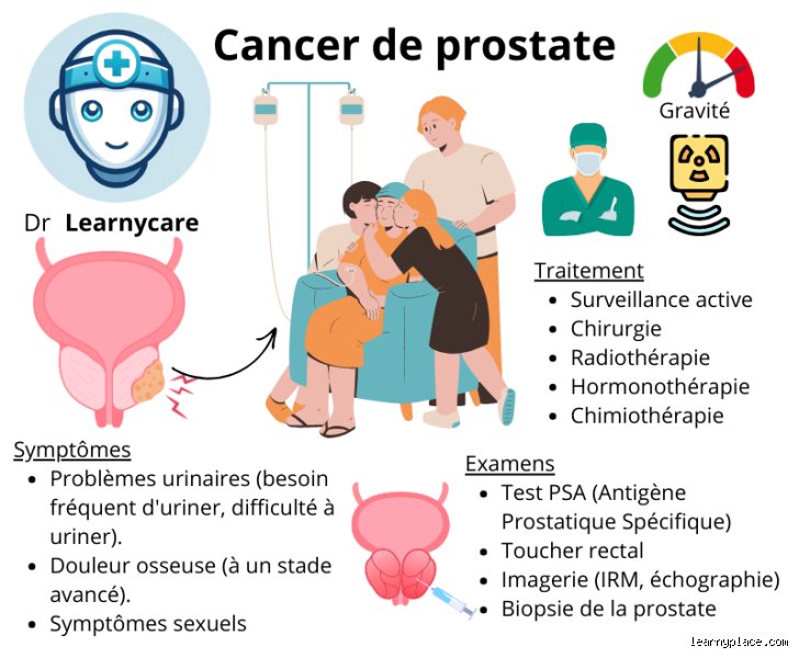 Quel est l'origine du cancer de la prostate ?