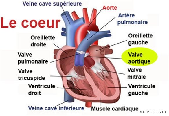 Quel traitement pour rétrécissement aortique ?