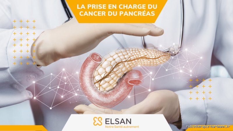 Durée de la chimiothérapie pour le cancer du pancréas : entre protocoles standards et réalité du terrain