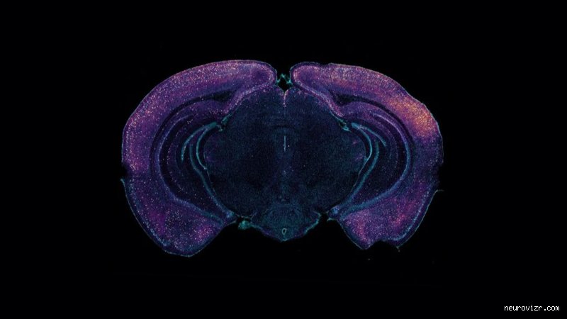 Le son à 40 Hz fonctionne-t-il réellement pour stimuler le cerveau ou est-ce un mirage acoustique ?
