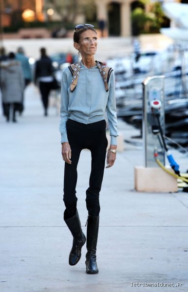 La Question Délicate : Quelle est la mannequin la plus maigre de l'histoire de la mode ?
