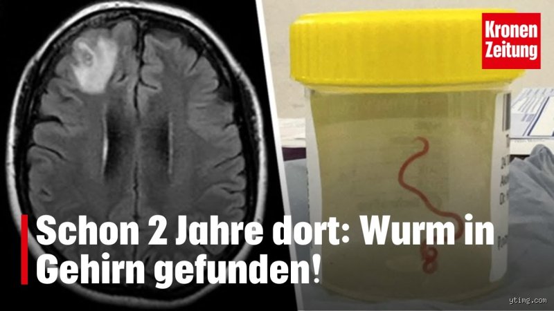 Hat ein Wurm ein Hirn? Die überraschende Wahrheit über die Nervenstruktur von Regenwürmern