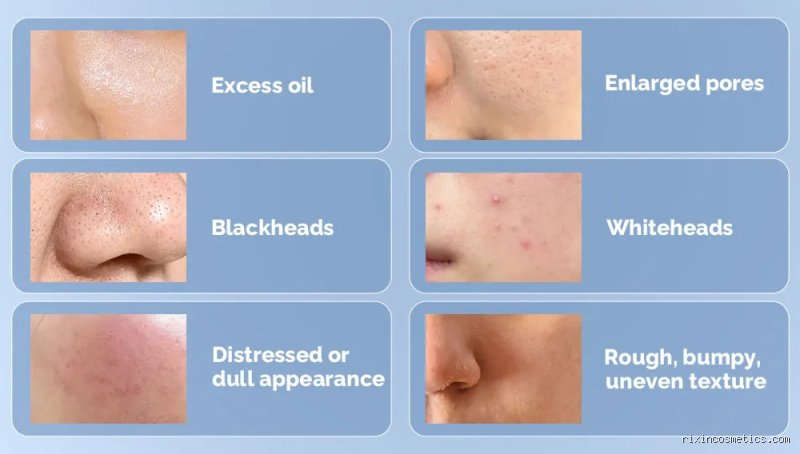 Comment déboucher les pores naturellement ?