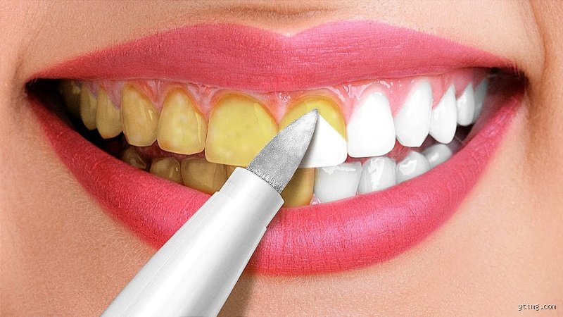 Comment avoir de belles dents blanches ?