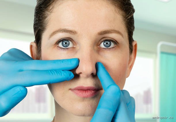 Est-ce que la chirurgie du nez fait mal ?