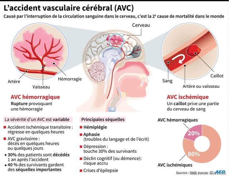 Est-ce que l'on souffre lors d'un AVC ? La réalité sur la douleur et l'urgence