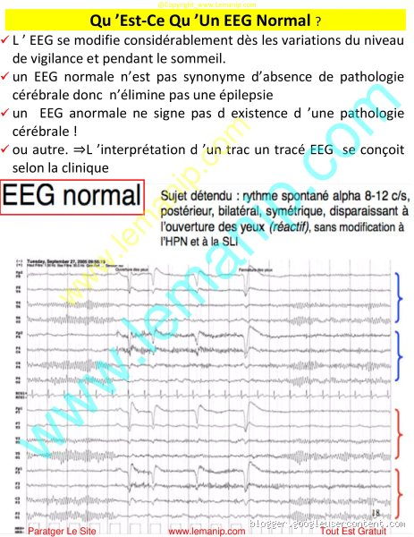 Qu'est-ce qu'un eg ?