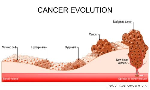 À quelle vitesse se propage un cancer ? La réalité complexe derrière la cinétique tumorale et les mécanismes de métastase