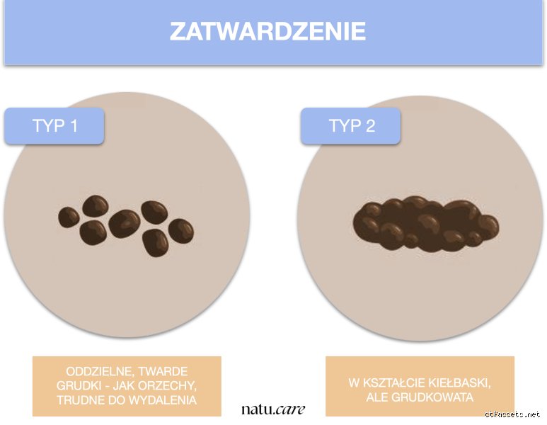 À quoi ressemblent vos selles si vous souffrez de pancréatite et pourquoi votre digestion déraille complètement ?