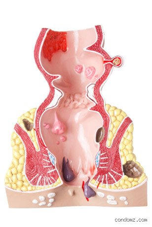 À quoi s'attendre après une pénétration anale : guide complet sur les sensations physiques et les réactions physiologiques immédiates