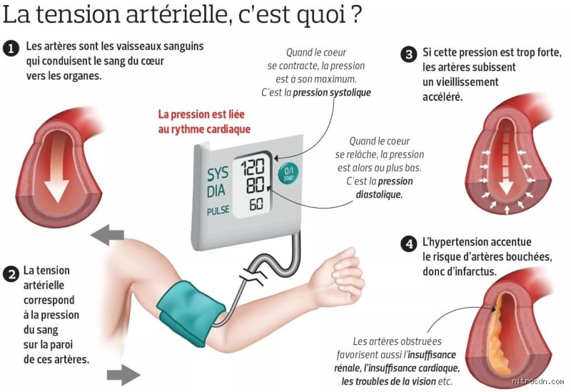 Ça fait quoi d'avoir une tension trop haute ? Plongée brute au cœur d'un fléau silencieux