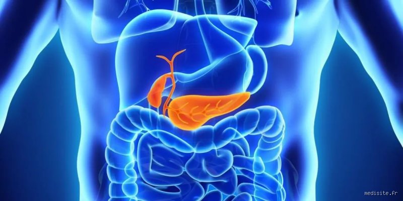Combien de temps dure une inflammation du pancréas ? Le guide complet sur la durée réelle de guérison