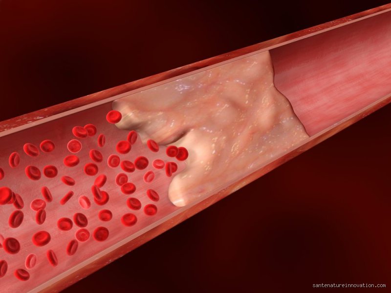 Combien de temps faut-il au K2 pour nettoyer les artères ? La vérité sur le délai d'action de cette vitamine méconnue
