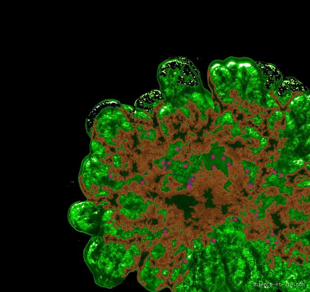 Combien de temps faut-il au pancréas pour se régénérer ? La vérité scientifique sur une guérison souvent méconnue