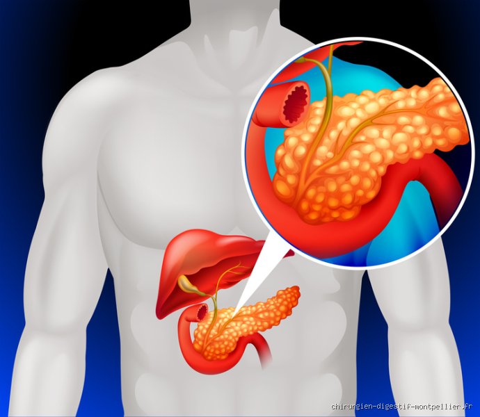 Combien de temps faut-il pour que le pancréas guérisse ? Le guide complet sur la régénération de cet organe méconnu