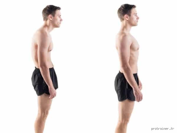 Comment corriger définitivement une mauvaise posture : le guide clinique pour reprogrammer son corps sans corset ni gadgets