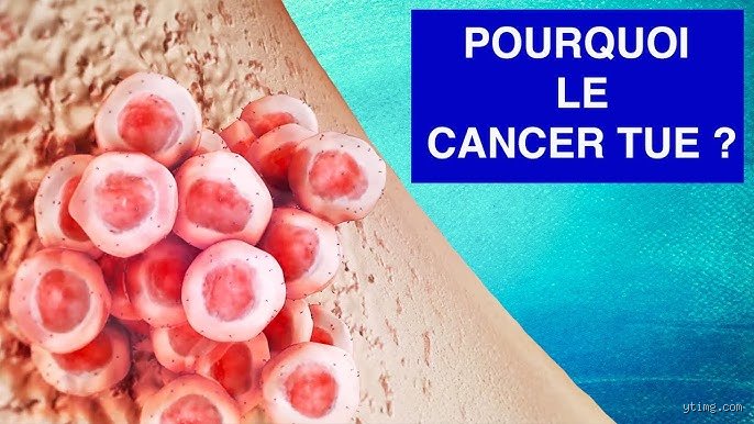 Comment décède-t-on d'un cancer ? Comprendre la mécanique biologique de la fin de vie en oncologie