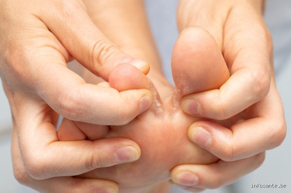 Comment éliminer les champignons de l'intérieur du corps : le guide complet pour assainir durablement son microbiote et retrouver de l'énergie