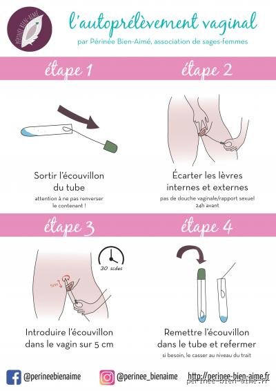 Comment être sûr que c'est une mycose : le guide expert pour ne plus confondre démangeaison passagère et infection fongique