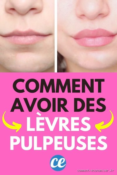 Comment faire pour maigrir une lèvre naturellement ?