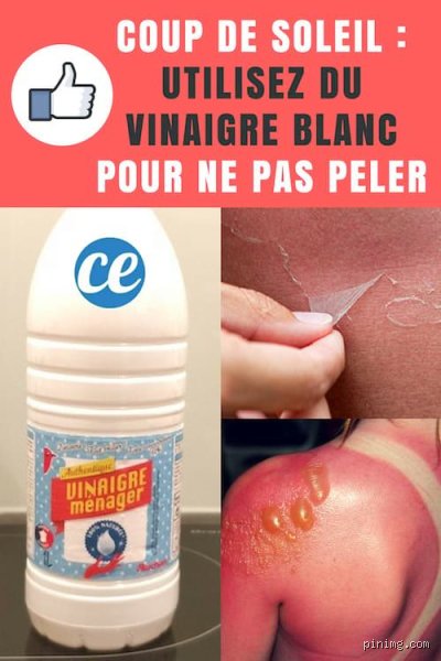 Comment faire pour ne plus avoir de cloques ?