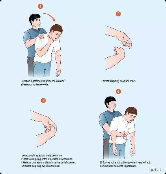 Comment faire quand une personne âgée fait une fausse route ? Le guide d'urgence et de prévention