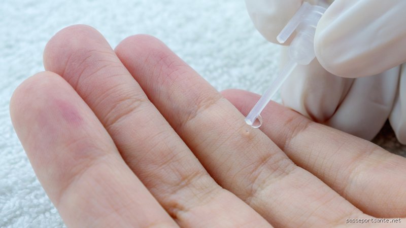 Comment guérir définitivement du papillomavirus : la vérité médicale entre élimination immunitaire spontanée et traitements de pointe