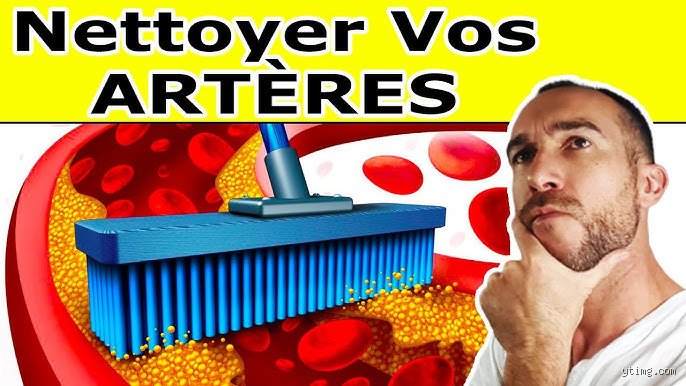 Comment nettoyer la plaque dans les artères ? La vérité médicale entre espoirs technologiques et limites biologiques