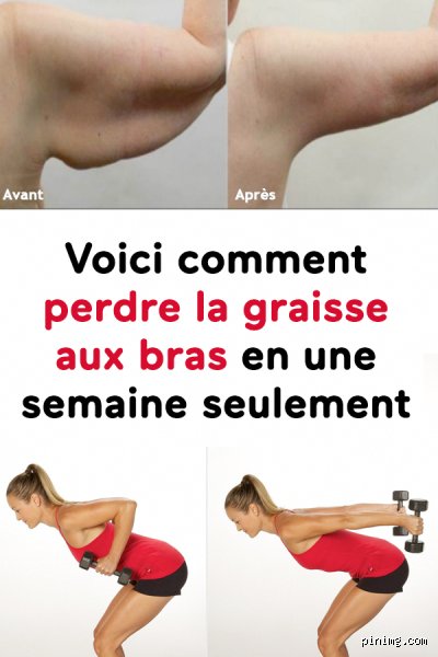 Comment perdre la graisse du bras rapidement ?
